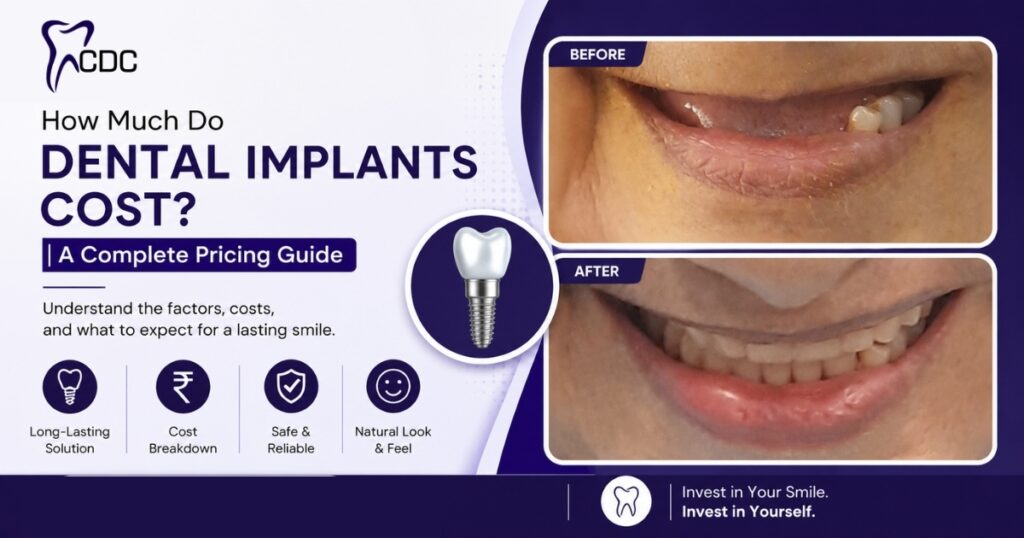 Dental Implants in Navi Mumbai