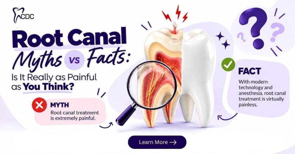 Root Canal Treatment in Navi Mumbai