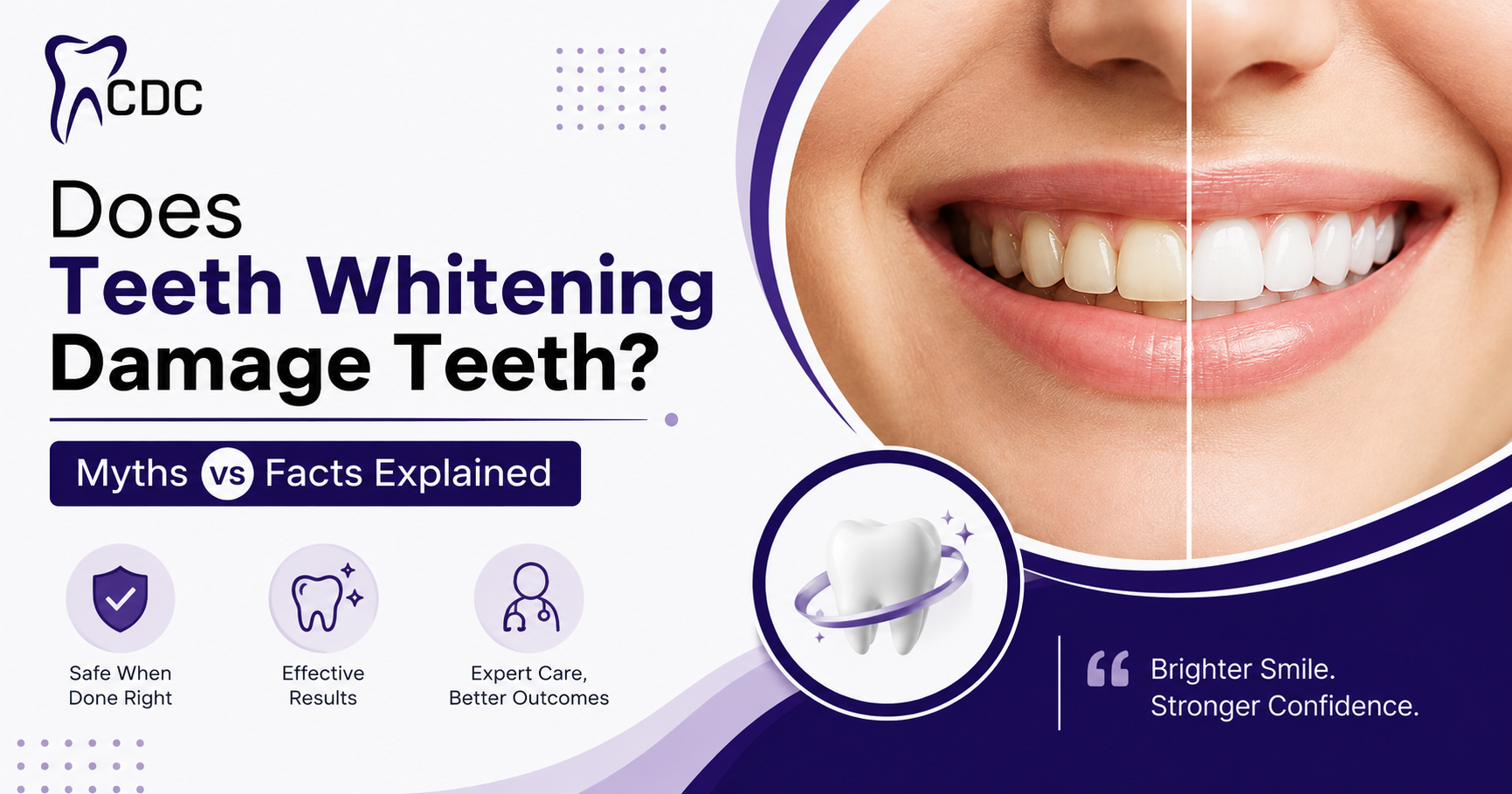 Teeth Whitening in Navi Mumbai
