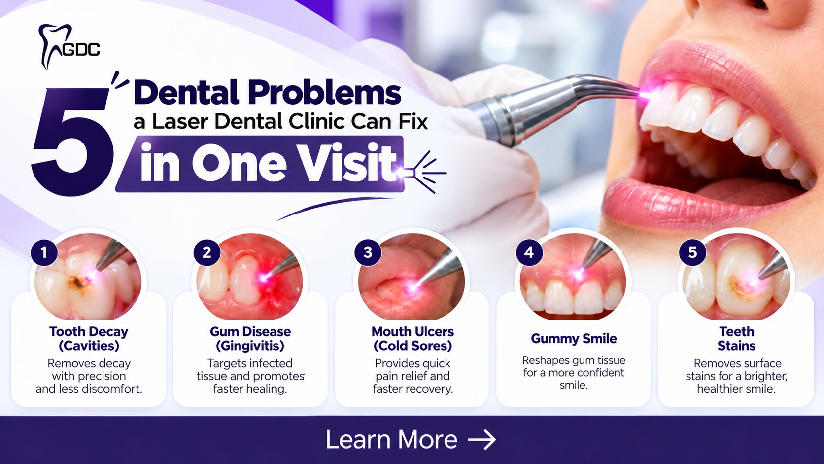 laser dental clinic